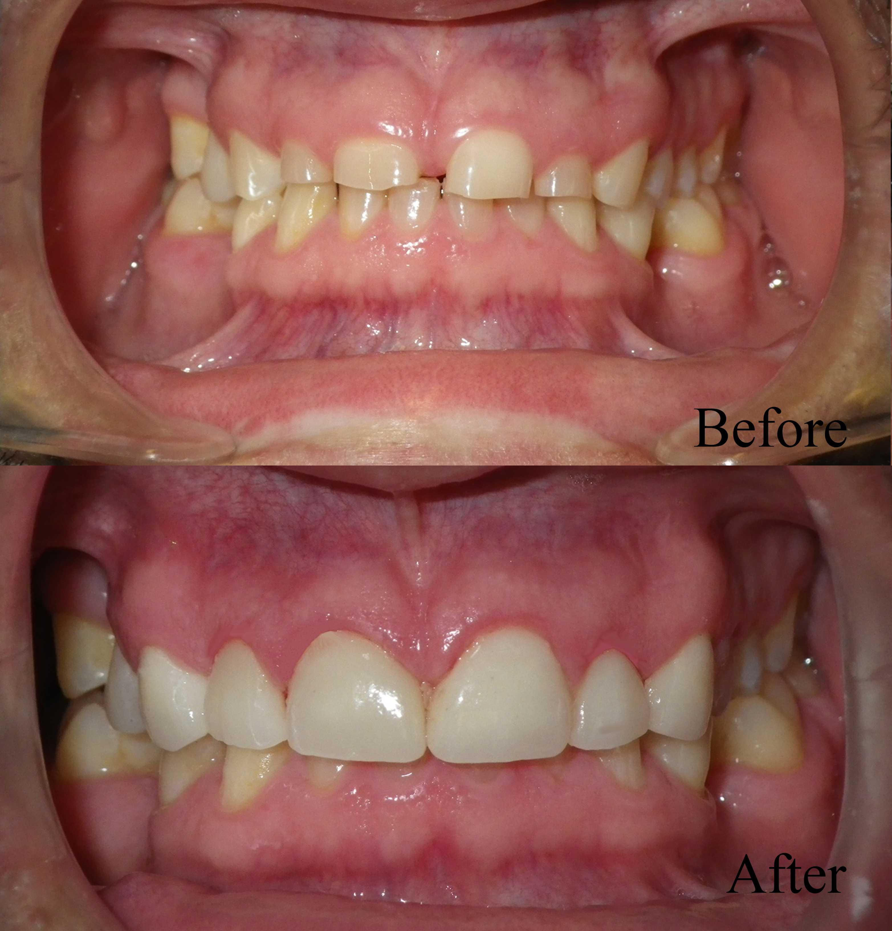 Dental Before & after